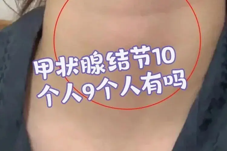 最近总在刷到李昕季烨和朱美吉很好磕，想知道他俩在一起了  第6张