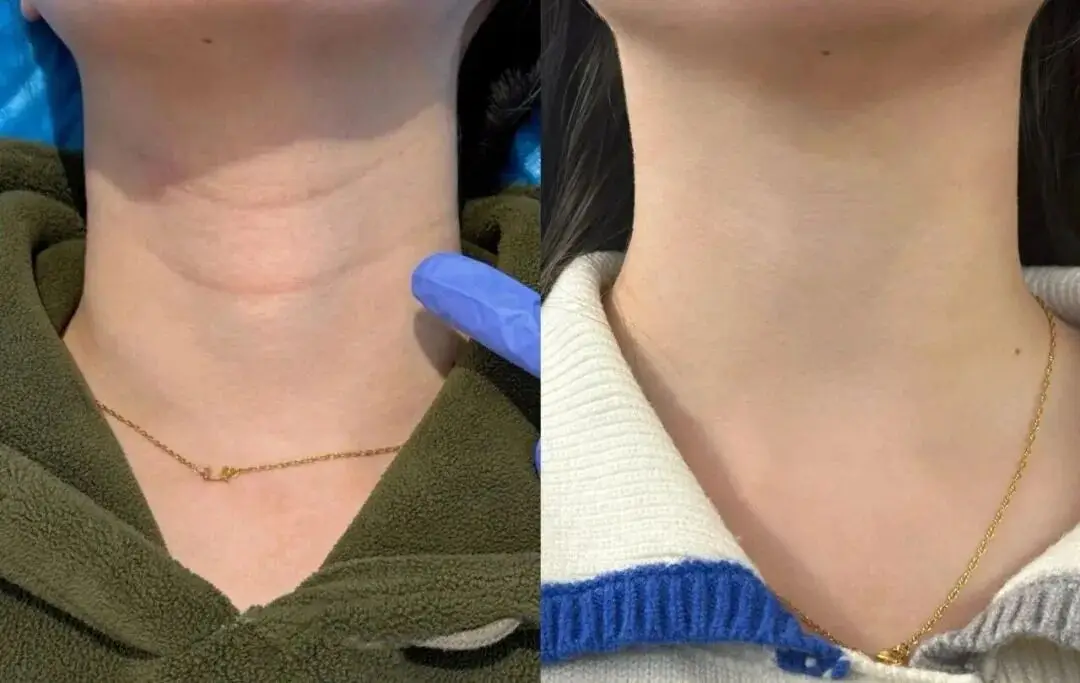 【2026.1.30】王鹤棣待爆帝？任宥纶郑合惠子？明星怎么祛颈纹？蒋欣和叶祖新？牢A的爆火对圈里有影响？  第1张